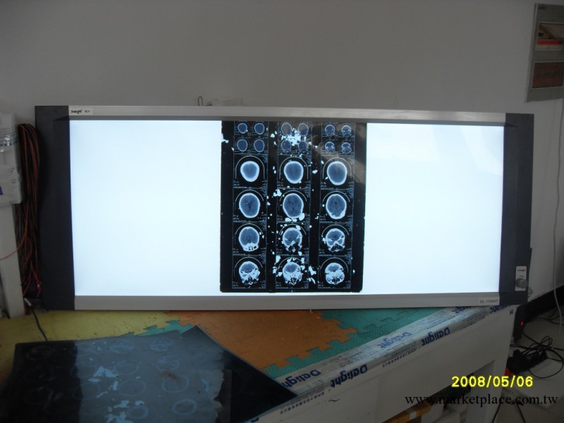 供應三聯DL-1100HT新型醫用led觀片燈工廠,批發,進口,代購