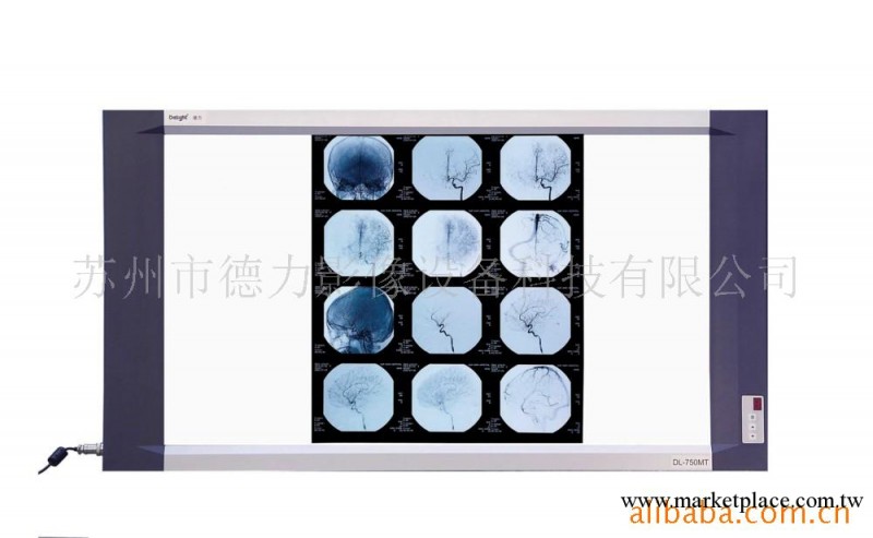 供應醫用觀片器工廠,批發,進口,代購