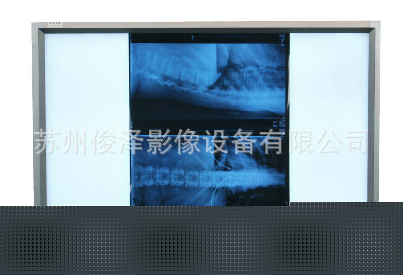 LED醫用閱片燈工廠,批發,進口,代購
