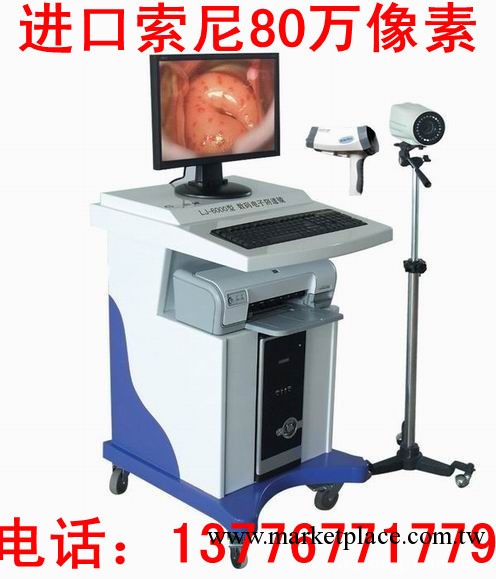 數位電子陰道鏡-婦科檢查機-婦科診斷機工廠,批發,進口,代購