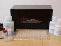 前列腺酸性磷酸酶測試盒/PACP測試盒批發・進口・工廠・代買・代購