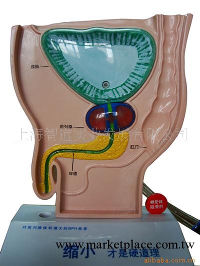 供應醫學模型-前列腺功能教學示范模型工廠,批發,進口,代購