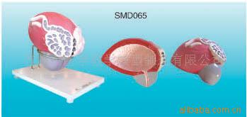 供應SMD065膀胱前列腺放大模型工廠,批發,進口,代購