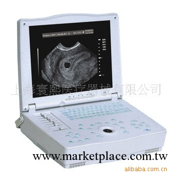 RH-300A 液晶屏便攜式超聲診斷機工廠,批發,進口,代購