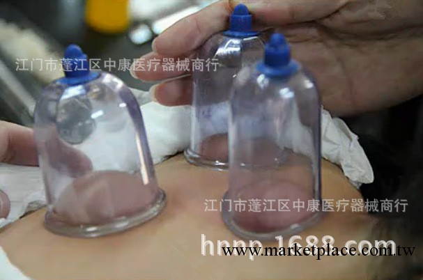 高品質專業拔罐 心天拔罐 瀉血療法 經絡保健器械 廠傢直銷工廠,批發,進口,代購