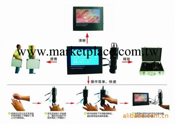 購買高清晰的彩色微循環檢測機就找上海響石工廠,批發,進口,代購