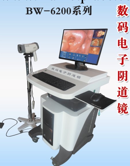 數位電子陰道鏡  新品招商  百維  BW-6200批發・進口・工廠・代買・代購