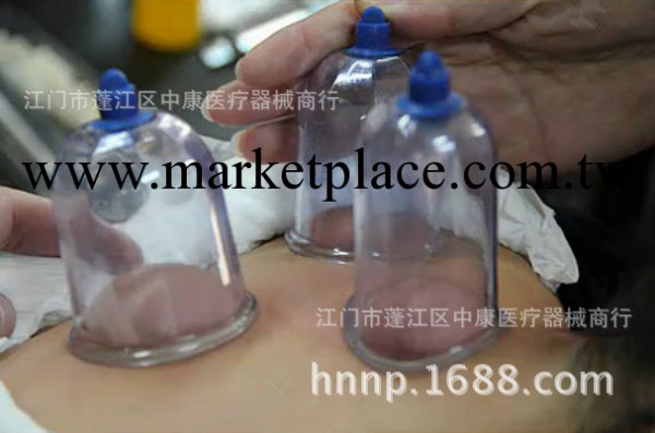 廠傢直銷 經絡保健器材 13頭拔罐 瀉血拔罐 矽膠氣閥工廠,批發,進口,代購