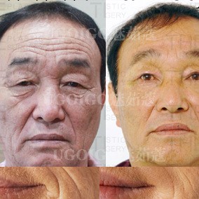 微針療法祛皺套裝 面部護理套裝護膚品套裝微針套裝 化妝品套裝工廠,批發,進口,代購
