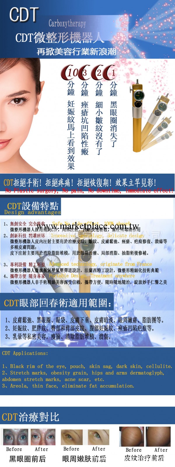 CDT微整形機器人|廠傢直銷氣化美塑機|韓國進口CDT小機器人配件工廠,批發,進口,代購