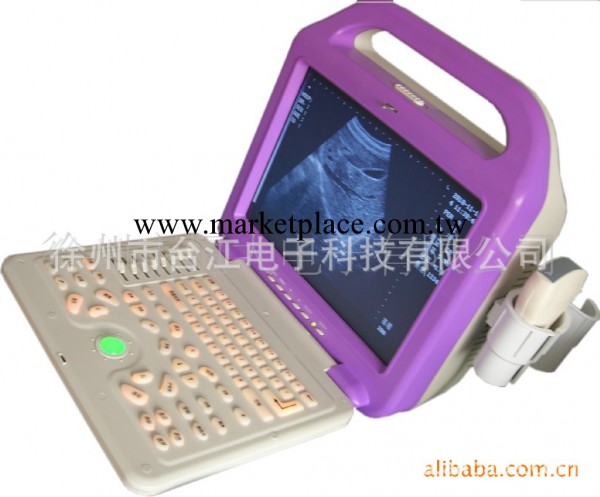 HD-318A手提式黑白B超機工廠,批發,進口,代購
