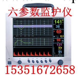 便攜式多參數監護機-心電監護機價格品牌-床邊監護機廠傢工廠,批發,進口,代購