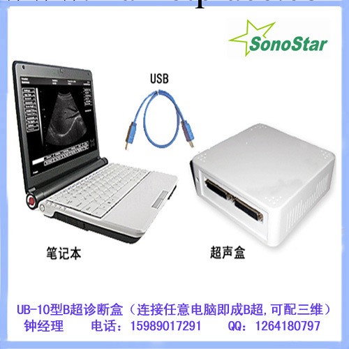 UBox-10型帶三維成像超聲盒（B超模塊盒）連電腦用B超工廠,批發,進口,代購