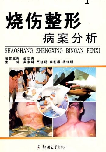 （正版）燒傷整形病案分析（C005）工廠,批發,進口,代購
