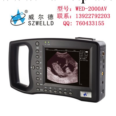WED-2000AV寵物B超|深圳威爾德B超|母豬懷孕檢測妊娠超聲診斷機工廠,批發,進口,代購