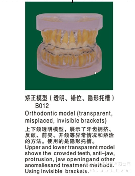 批瞭牙齒模型 固定矯正模型（透明、錯位，隱形托槽）B012工廠,批發,進口,代購