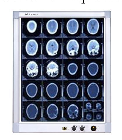 北京產手術室電腦調光調幅單聯超薄高亮閱片燈醫用LED智能觀片燈工廠,批發,進口,代購