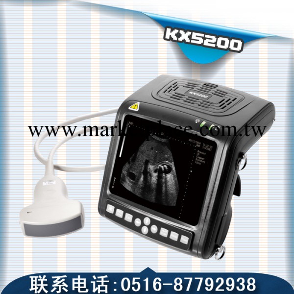 【手臂式掌上B超機】體積小，重量輕，易於攜帶，方便出診 KX5200工廠,批發,進口,代購