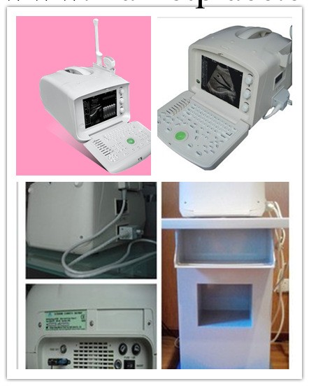 B型超聲診斷機/黑白B超/B超機/便攜式（數字人用)----廠傢直供工廠,批發,進口,代購