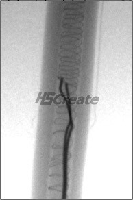 電加熱絲透視機 源於HSCreate恒勝創新高清電加熱絲透視機工廠,批發,進口,代購