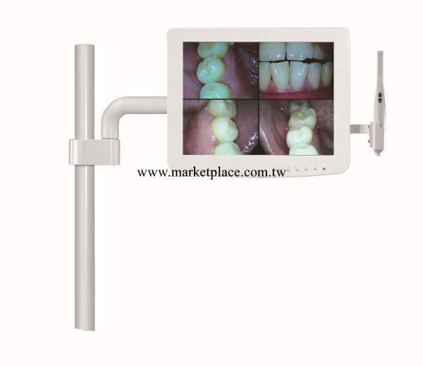 口腔內窺鏡一體機，觸摸屏Win7、無線上網、可接心電監護高配批發・進口・工廠・代買・代購