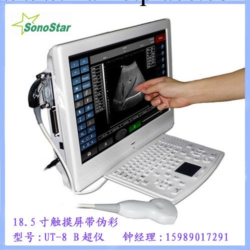 U8 觸摸屏偽彩三維便攜式B超診斷機|全數字臺式18.5寸液晶B超機工廠,批發,進口,代購