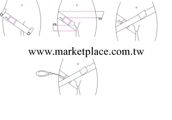 股動脈穿刺止血帶工廠,批發,進口,代購