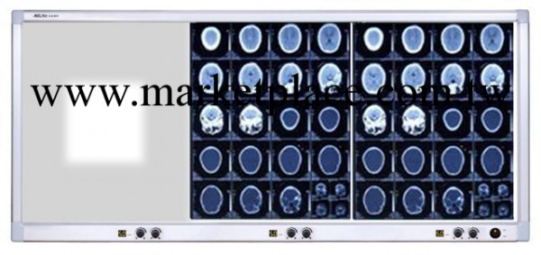 加工定制電腦調光調幅三聯超薄高亮閱片燈醫用LED智能觀片燈批發・進口・工廠・代買・代購