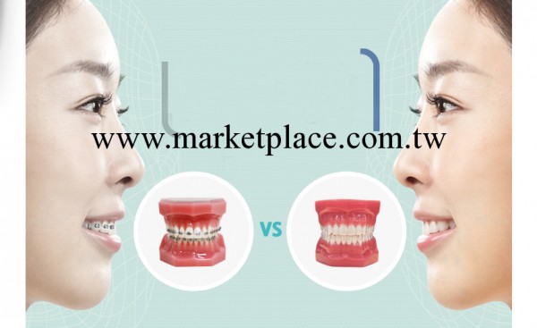 韓國牙科 韓國矯正牙齒 牙齒矯正器 量大從優 招商代理批發・進口・工廠・代買・代購
