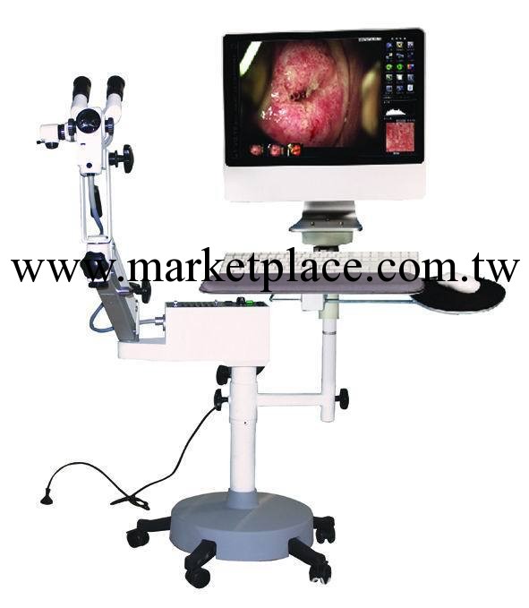 【高端  高品質】專業醫用機器 光學陰道鏡工廠,批發,進口,代購