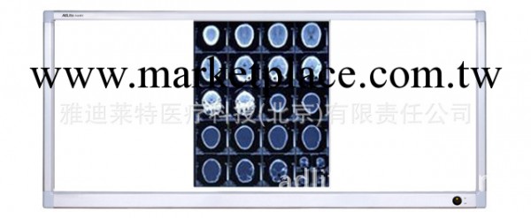 北京批發零售手術室三聯超薄液晶閱片燈標準LED醫用觀片燈批發・進口・工廠・代買・代購