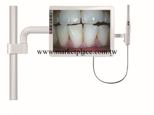 15寸顯示器口腔內窺鏡批發・進口・工廠・代買・代購