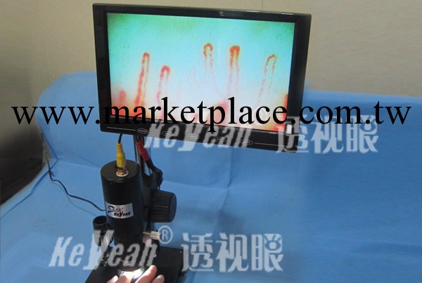 供應廣東省廣州市  便攜式 微循環檢測機  透視眼專業生產批發・進口・工廠・代買・代購