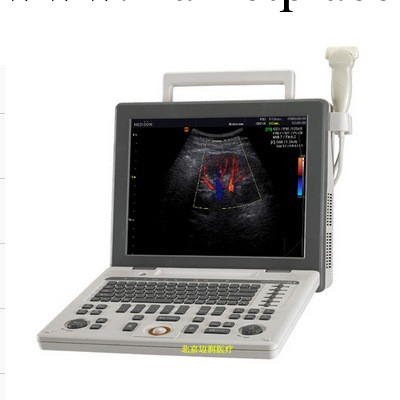 麥迪遜SONOACE R3便攜式彩超工廠,批發,進口,代購