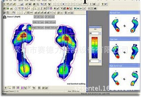 足底壓力測試S-Fcen工廠,批發,進口,代購