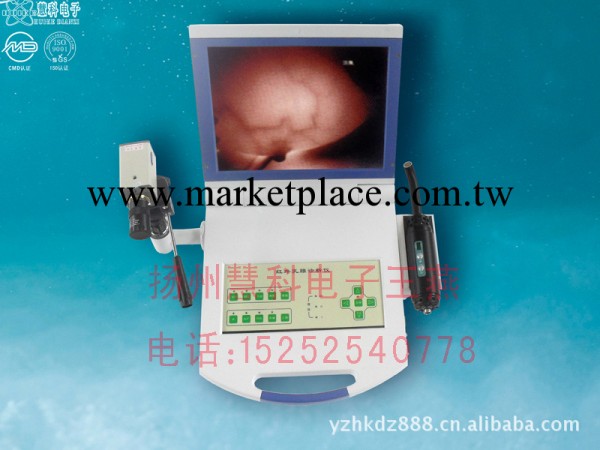 乳透機生產廠傢 乳腺診斷機特價工廠,批發,進口,代購