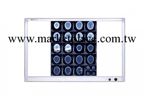北京批發零售雙聯看片燈超薄液晶閱片燈醫用LED調光觀片燈批發・進口・工廠・代買・代購