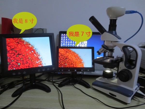 上海馨迪一滴血檢測機 生物視頻顯微鏡XD-MDI-J一體機蟎蟲檢測機批發・進口・工廠・代買・代購