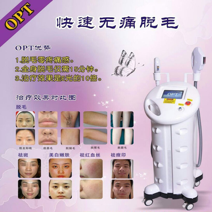 opt無痛快速脫毛機祛斑祛皺機美容機器去血絲修復美白嫩膚美容院工廠,批發,進口,代購