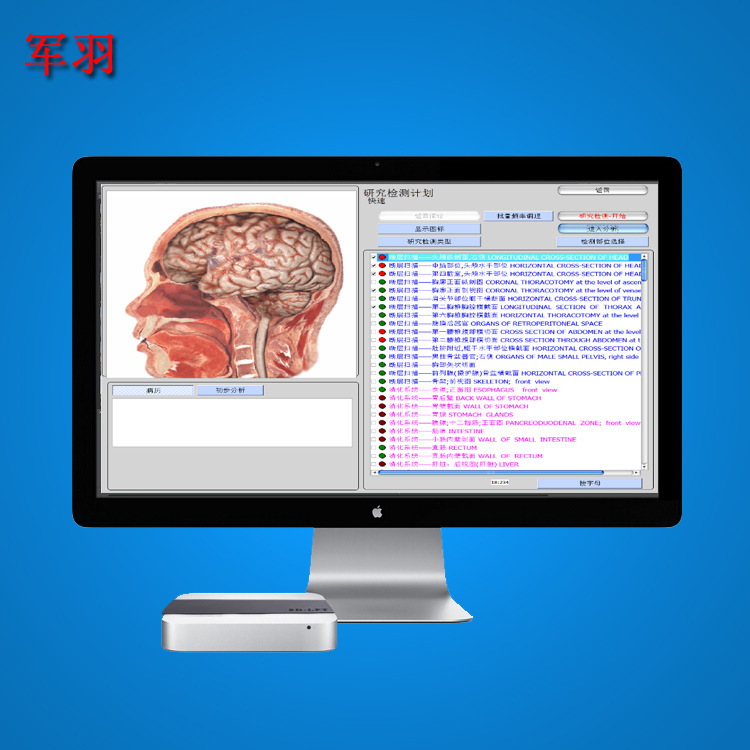 【廠傢直銷】3dcell升級版9DCELL 9D-NLS亞健康檢測機工廠,批發,進口,代購