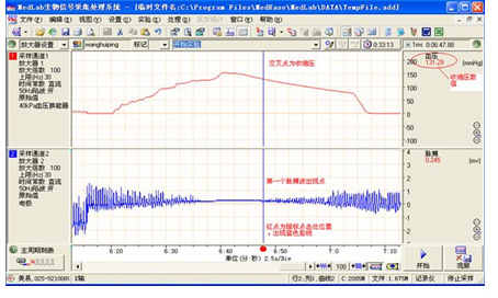 無創尾動脈血壓測量分析系統 四通道工廠,批發,進口,代購