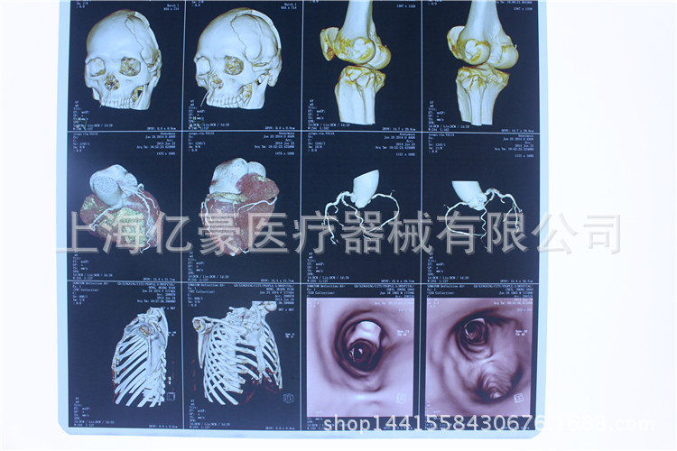 【專業供應】激光膠片B超膠片A4激光打印膠片 醫療膠片激光B超片工廠,批發,進口,代購