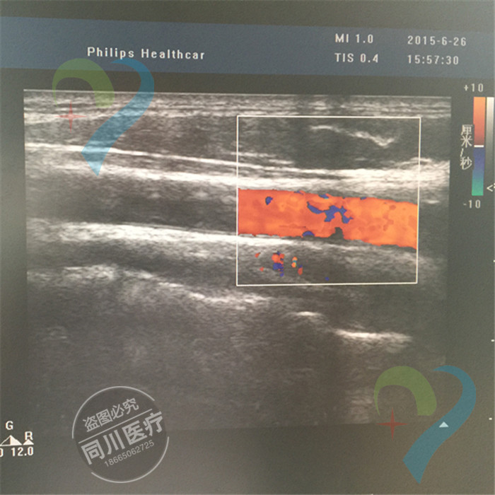 PHILIPS淺表探頭供應飛利浦L17-5小器官探頭線纜維修 陣元更換工廠,批發,進口,代購