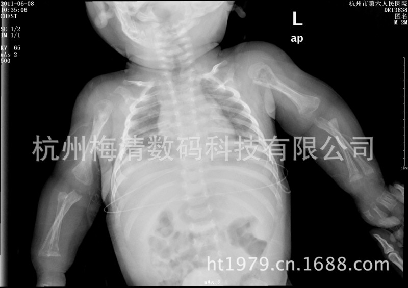 Dry film  醫院乾膜X光攝影片工廠,批發,進口,代購