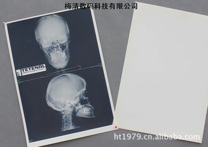 Dry film    Dry laser filmX-ray film工廠,批發,進口,代購