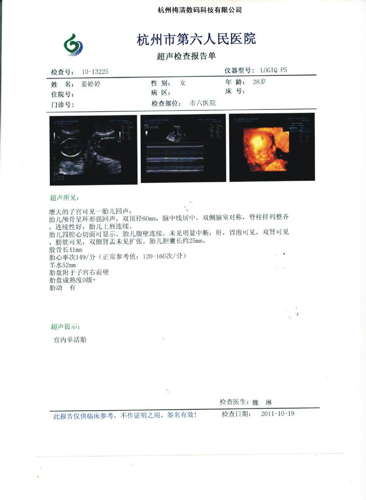 乾式激光膠片  醫用彩色激光膠片 一次性醫用耗材 醫院CT室照CT用工廠,批發,進口,代購