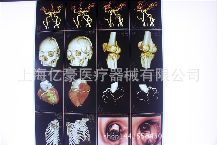 【專業供應】醫用噴墨膠片 高清噴墨醫用膠片 醫用噴墨放射膠片工廠,批發,進口,代購