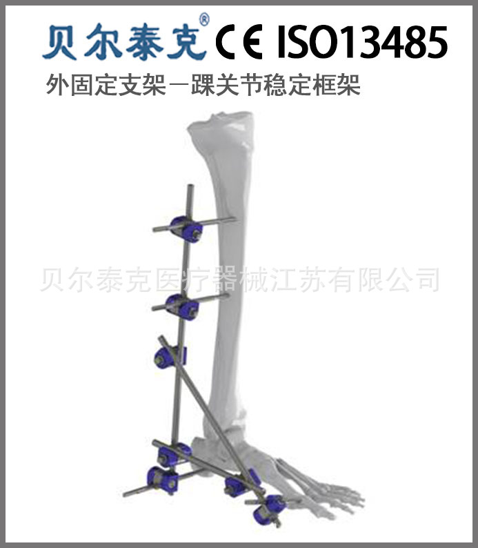 骨科三維固定的模塊式外固定支架多功能型踝關節穩定框架工廠,批發,進口,代購