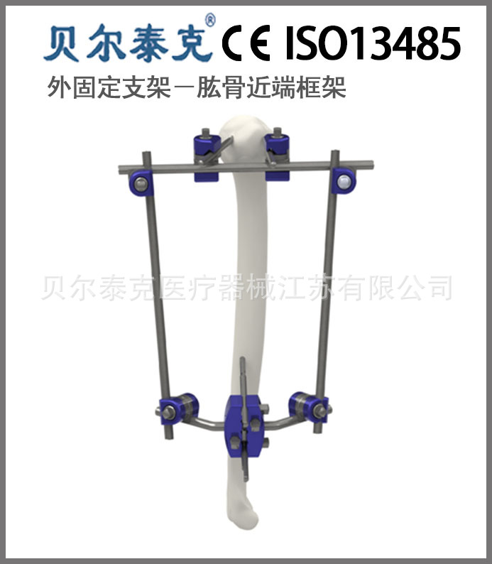 骨科三維固定的模塊式外固定支架多功能型肱骨近端框架工廠,批發,進口,代購