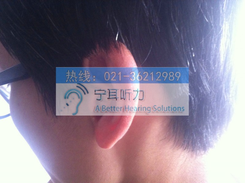 峰力倫巴夢微型版深耳道式Virto Q70-10 NW 0 SP助聽器價格可議價工廠,批發,進口,代購